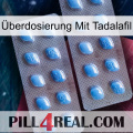 Überdosierung Mit Tadalafil viagra4